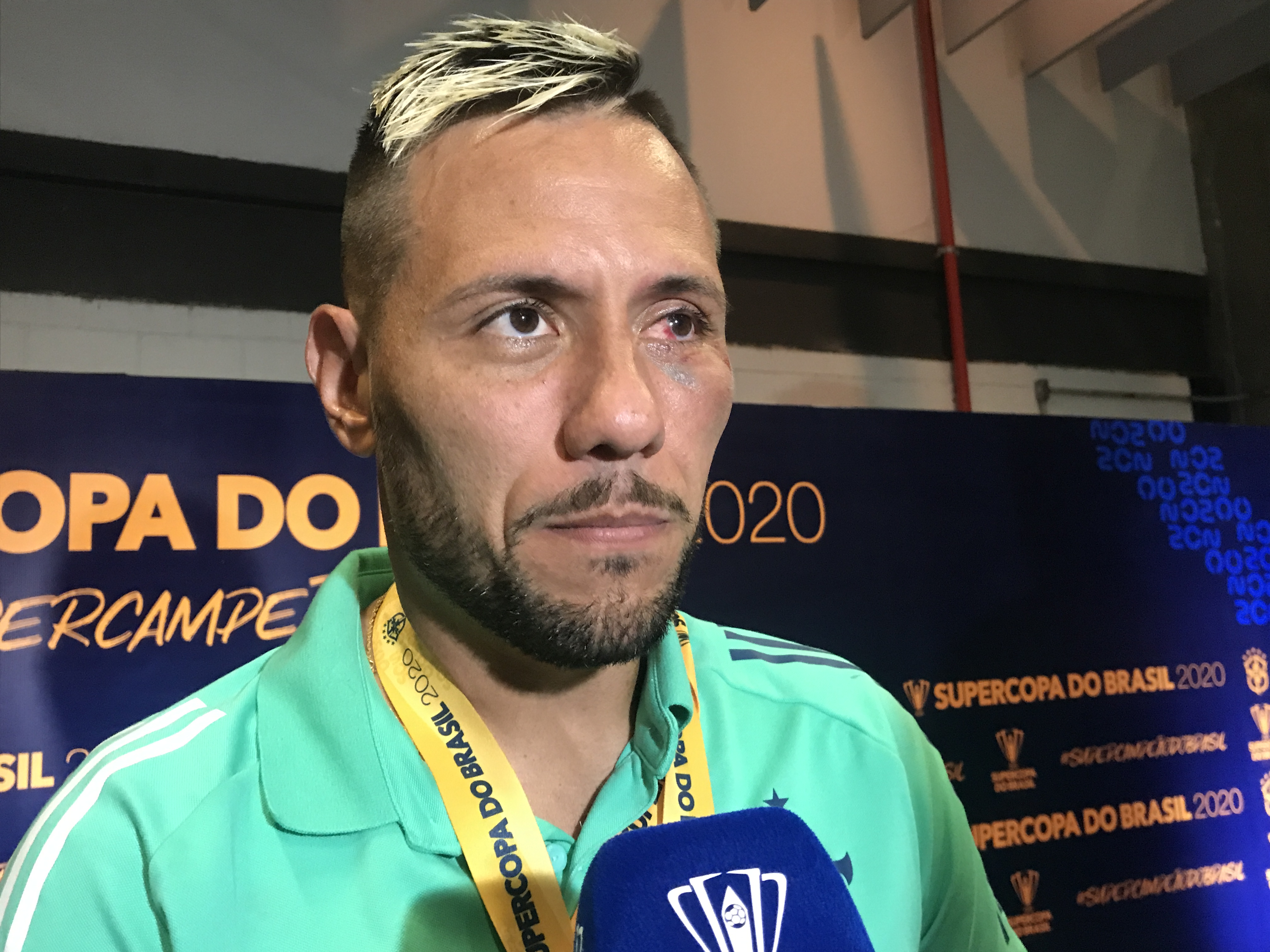 Diego Alves sai do Mané Garrincha supercampeão e de olho roxo